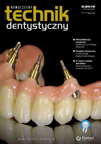 Nowoczesny Technik Dentystyczny 3_2019.jpg