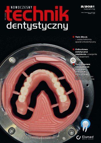 Nowoczesny Technik Dentystyczny | nr 2/2021