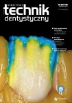 Nowoczesny Technik Dentystyczny | nr 3/2018 [pdf]
