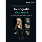 Tomografia stożkowa w praktyce endodontycznej