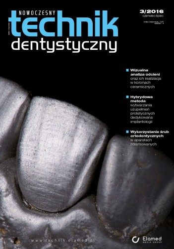 Nowoczesny Technik Dentystyczny | nr 3/2016