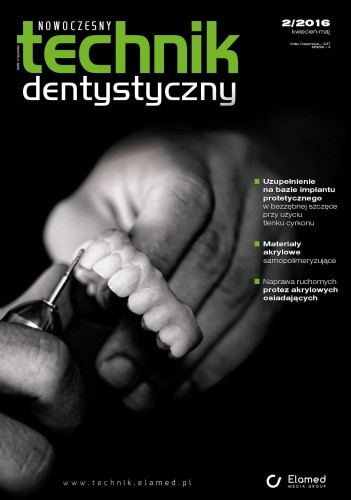 Nowoczesny Technik Dentystyczny | nr 2/2016