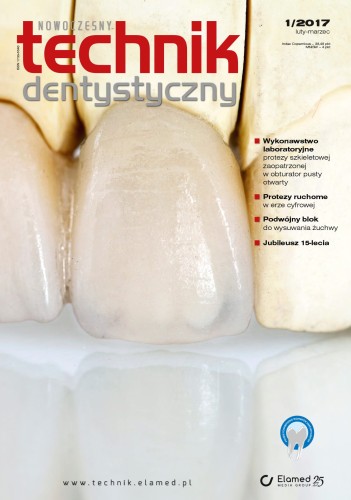 Nowoczesny Technik Dentystyczny | nr 1/2017