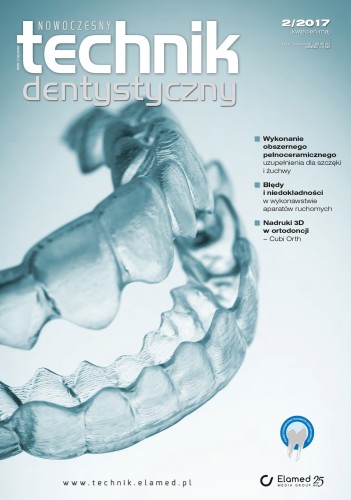 Nowoczesny Technik Dentystyczny | nr 2/2017